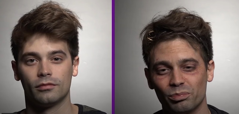 Трансформация: Как дрогата променя начина, по който изглежда човек (видео)